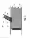 Fig. 34 - STENT GRAFT FENESTRATION