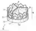 Fig. 01 - PROSTHETIC VALVE FOR CATHETER DELIVERY