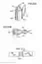Fig. 33 - PROSTHETIC VALVE FOR CATHETER DELIVERY