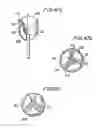 Fig. 53 - PROSTHETIC VALVE FOR CATHETER DELIVERY