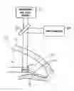 Fig. 01 - Implantable devices and methods for measuring intraocular, subconjunctival or subdermal pressure and/or analyte concentration
