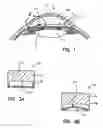 Fig. 02 - Implantable devices and methods for measuring intraocular, subconjunctival or subdermal pressure and/or analyte concentration