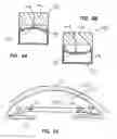 Fig. 07 - Implantable devices and methods for measuring intraocular, subconjunctival or subdermal pressure and/or analyte concentration