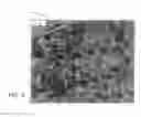 Fig. 07 - SILICONE IMPLANT WITH IMPRINTED TEXTURE