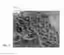 Fig. 08 - SILICONE IMPLANT WITH IMPRINTED TEXTURE