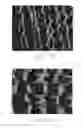 Fig. 16 - SILICONE IMPLANT WITH IMPRINTED TEXTURE