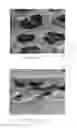 Fig. 17 - SILICONE IMPLANT WITH IMPRINTED TEXTURE