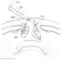 Fig. 01 - Methods and devices for rhinoplasty and treating internal valve stenosis