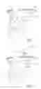 Fig. 04 - Methods and devices for rhinoplasty and treating internal valve stenosis