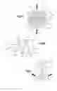 Fig. 12 - Expandable implant