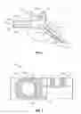 Fig. 03 - C1-C2 implant and methods of use