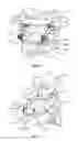 Fig. 05 - C1-C2 implant and methods of use