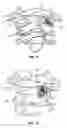 Fig. 08 - C1-C2 implant and methods of use