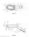 Fig. 12 - C1-C2 implant and methods of use