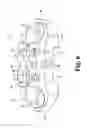 Fig. 05 - Interbody spinal implants with extravertebral support plates