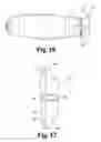 Fig. 14 - Interbody spinal implants with extravertebral support plates