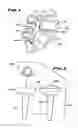 Fig. 02 - Facet arthroplasty devices and methods