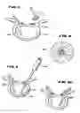 Fig. 05 - Facet arthroplasty devices and methods