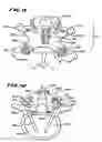 Fig. 06 - Facet arthroplasty devices and methods