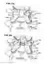 Fig. 11 - Facet arthroplasty devices and methods