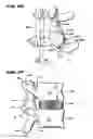 Fig. 12 - Facet arthroplasty devices and methods