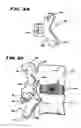 Fig. 16 - Facet arthroplasty devices and methods