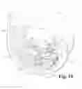Fig. 07 - Structures for use in orthopaedic implant fixation and methods of installation onto a bone