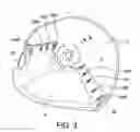 Fig. 05 - Adjustable prosthetic limb socket