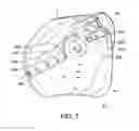 Fig. 10 - Adjustable prosthetic limb socket