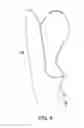 Fig. 11 - Adjustable prosthetic limb socket