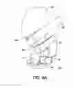Fig. 12 - Adjustable prosthetic limb socket
