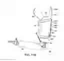 Fig. 16 - Adjustable prosthetic limb socket