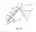 Fig. 17 - Adjustable prosthetic limb socket