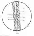 Fig. 03 - Sealing sheath for prosthetic liner and related methods