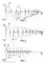 Fig. 03 - Active shimmy mitigation