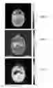 Fig. 07 - SYSTEM AND METHOD FOR ESTIMATING RADIATION DOSE AND DISTRIBUTION USING MEDIUM-DEPENDENT-CORRECTION BASED ALGORITHMS (MDC)