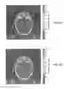 Fig. 10 - SYSTEM AND METHOD FOR ESTIMATING RADIATION DOSE AND DISTRIBUTION USING MEDIUM-DEPENDENT-CORRECTION BASED ALGORITHMS (MDC)
