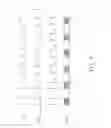 Fig. 04 - Ultrasonic phase-shift detection device