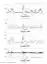 Fig. 11 - Method and apparatus for resolving individual signals in detector output data