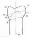Fig. 01 - DIGITISATION OF DENTAL PARTS