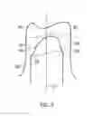 Fig. 05 - DIGITISATION OF DENTAL PARTS