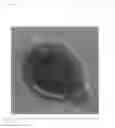 Fig. 10 - Phytophthora Nejat-Spina