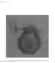 Fig. 16 - Phytophthora Nejat-Spina