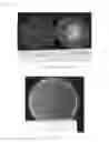 Fig. 33 - Phytophthora Nejat-Spina