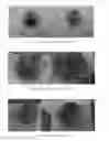 Fig. 45 - Phytophthora Nejat-Spina