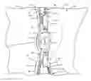 Fig. 01 - Zipper arrangement