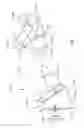 Fig. 02 - Device for Removing Excess Fluid from a Sponge