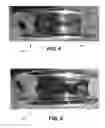 Fig. 05 - ROPE THIMBLE WITH CLOSED CURVE