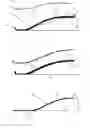 Fig. 03 - Orthotic Device and Method of Manufacture
