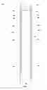 Fig. 05 - Closure assemblies for movable partitions, movable partition systems including closure assemblies and related methods